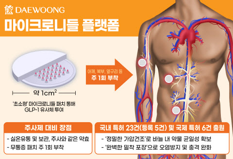 [대웅제약 사진자료] 대웅제약 마이크로니들 플랫폼